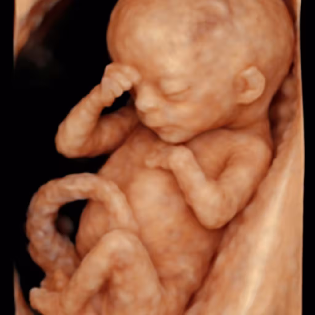 Ultrasonido estructural de primer y segundo trimestre (realizado por médico materno fetal) - Dra. Aida González